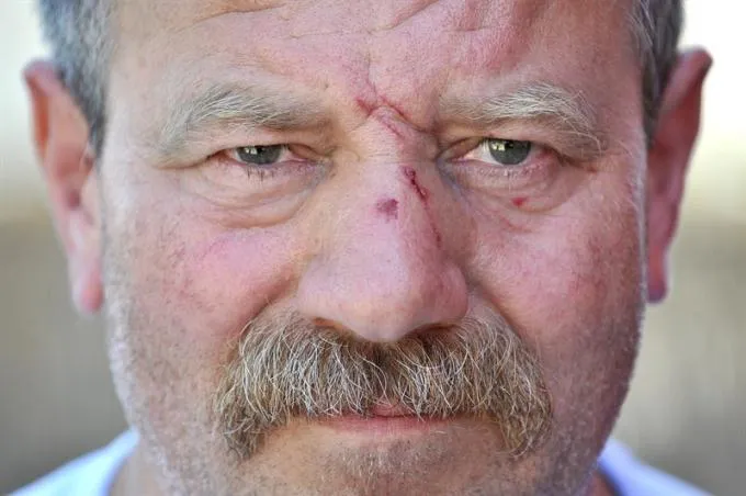 Goran Perović Mungos, trgovac napadnut u Zadru zbog fiskalne blagajne: Ministre Liniću, nastavite s čišćenjem švercera s tržnica